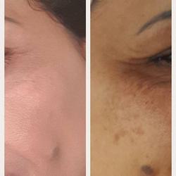Laurence skin care
